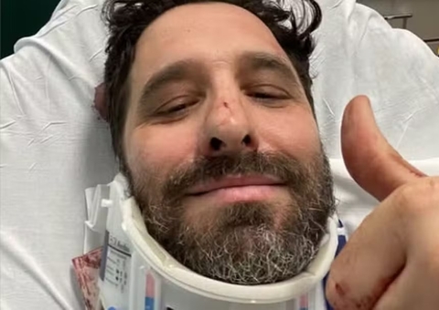 Rafinha Bastos sofre acidente em Nova York