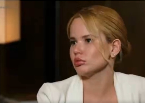 Namorada de Dado Dolabella explica hematoma e nega ter sido agredida; vídeo