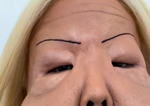 "Juju do pix" inicia jornada de reparação após deformação por óleo mineral no rosto