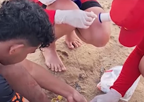 Seis banhistas ficam feridos em novo ataque de piranhas em balneário em Manacapuru 