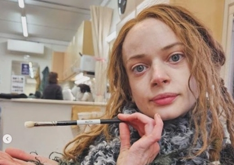 Aos 29, atriz de 'Como Treinar o Seu Dragão" revela que amputou 2ª perna