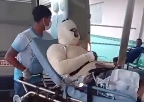Funcionário tem parte do corpo queimado durante explosão em empresa em Itacoatiara