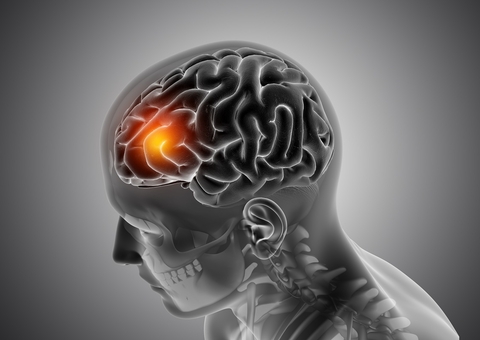 Anticoncepcional, tabagismo e hormônios: os principais riscos de AVC em jovens