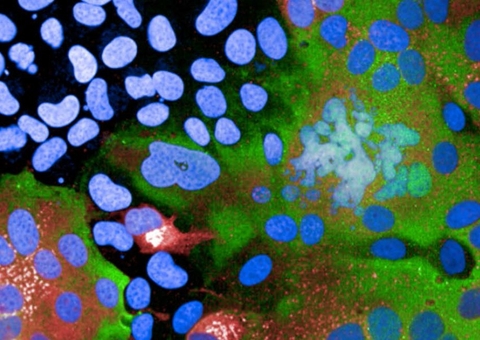 Vacinas AstraZeneca e Pfizer são eficientes contra variante delta após 2ª dose