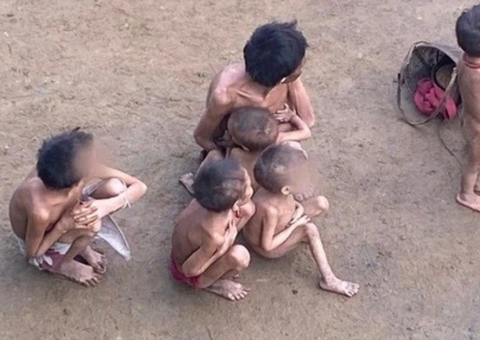 Deputado venezuelano diz que yanomamis desnutridos vieram de seu país para o Brasil