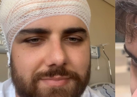 Zé Neto choca ao mostrar corte enorme na cabeça após acidente 