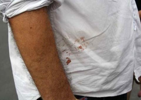 Sindicalista sai ferido em protesto na Arena Amazônia