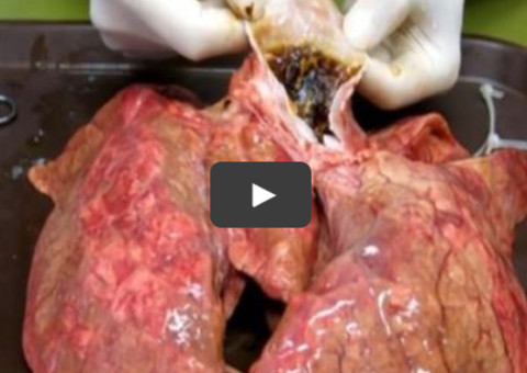 Vídeo, professor usa pulmão de verdade para mostrar como fica o estado de um pulmão depois de fumar 60 cigarros