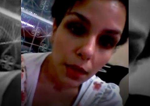 Mulher perde dedos dos pés após tratamento com anticoncepcional: "Quase me matou"