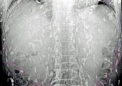 Homem quase morreu após comer sushi estragado