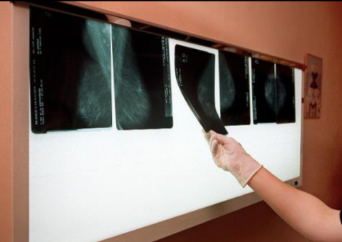 Remédio contra câncer provoca graves reações na pele