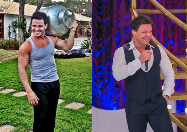 Eduardo Costa exagera na cirurgia plástica