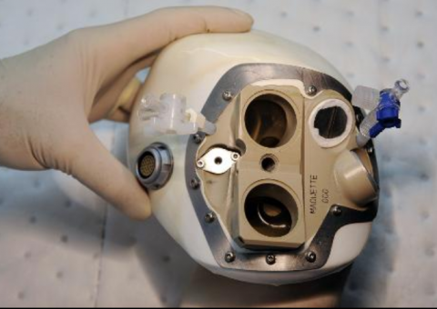 Coração artificial autônomo é implantado em paciente pela primeira vez