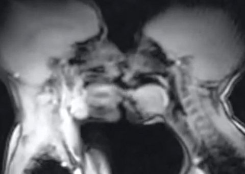  Casal faz sexo em máquina de ressonância magnética, veja resultado