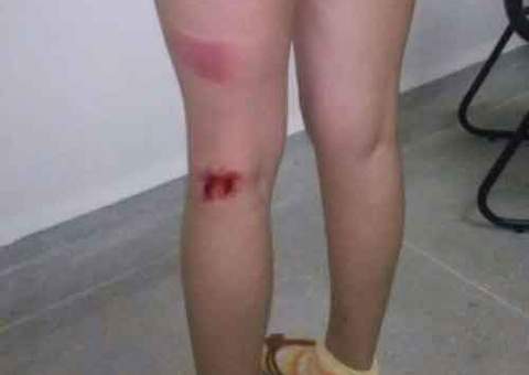 Vereador é acusado de agredir namorada da filha