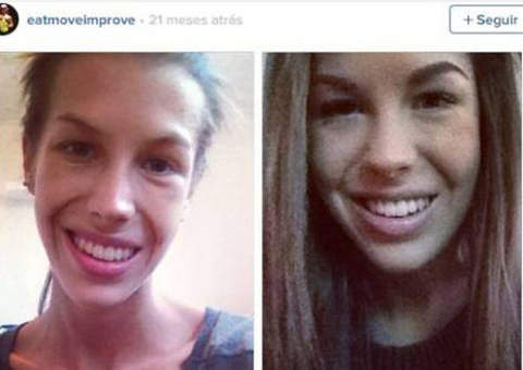 Jovem com anorexia mostra sua batalha como exemplo