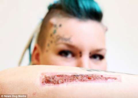 Jovem traída corta tatuagem com o nome do namorado 