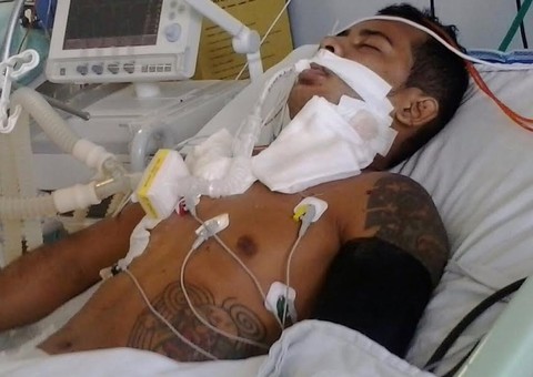 Traficante baleado está na UTI