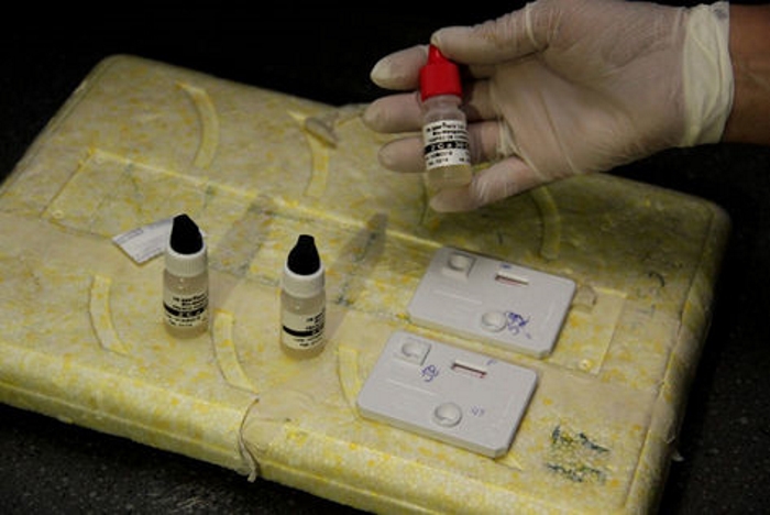 Números de DST/AIDS ultrapassam a 1.200 casos em 2014, diz Semsa 