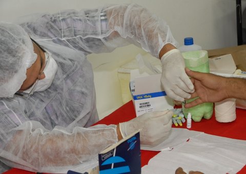 Prefeitura amplia oferta de teste rápido em HIV, sífilis e hepatites