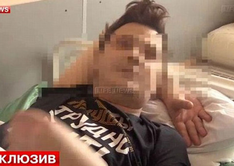 Ator curte noitada com 'loira' e acorda sem os testículos 