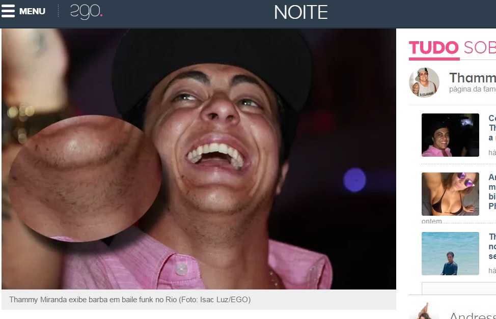  Thammy Miranda começa a ter barba após retirar seios