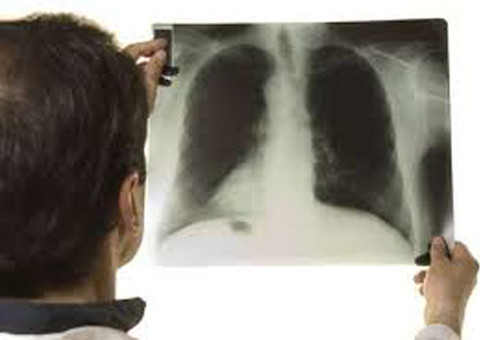 Campanha de combate à tuberculose na Feira da Panair 