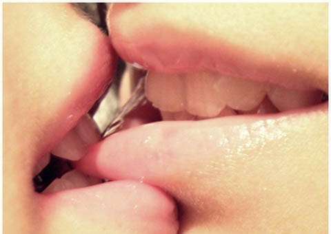 Principais doenças que uma pessoa pode pegar ao beijar um desconhecido