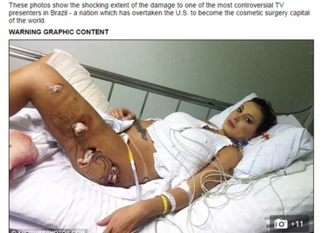 Fotos de Andressa Urach no hospital são destaque na imprensa internacional