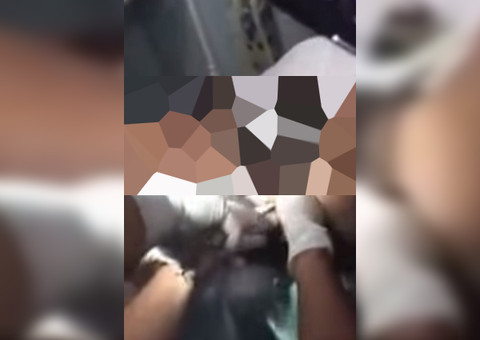  No Brasil, vídeo mostra médicos retirando drogas da vagina de mulher