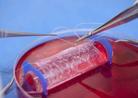 Garotas recebem órgãos genitais artificiais nos EUA