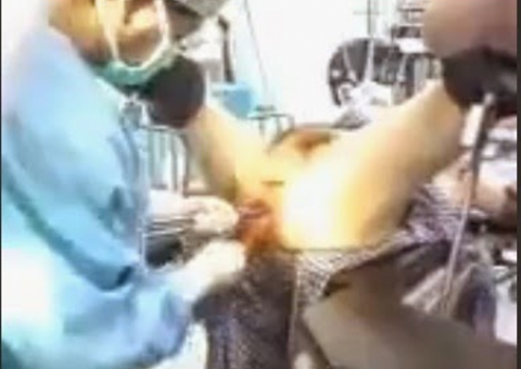 Homem coloca prótese de pênis no ânus e vai parar no hospital