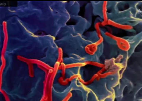 Ebola: Vídeo traz perguntas e respostas sobre a doença