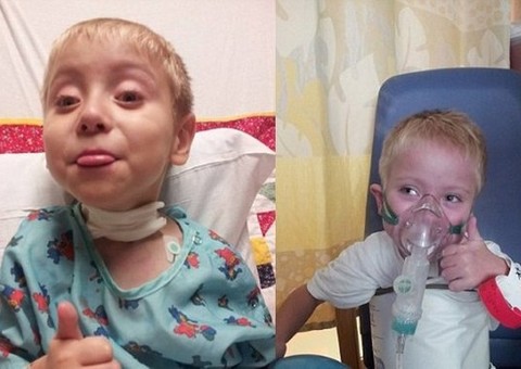 Após engolir bateria, garoto de 5 anos precisa passar por 65 cirurgias