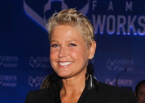 Xuxa Meneghel diz que médica fez botox sem autorização 